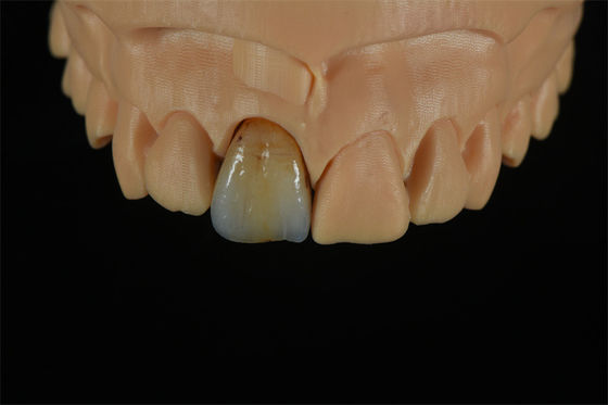 คุณภาพ  Affordable Zirconia Crowns with Custom Color Staining - China Dental Lab โรงงาน